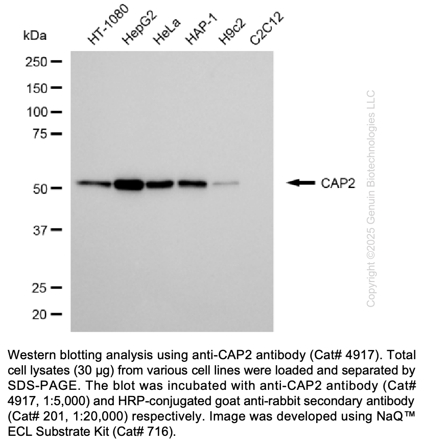 Anti-CAP2 Rabbit Monoclonal Ab #4917