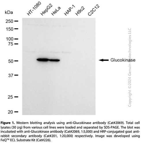 Curated visual reference: Picture Idea: Anti Glucokinase Rabbit Mab 2069