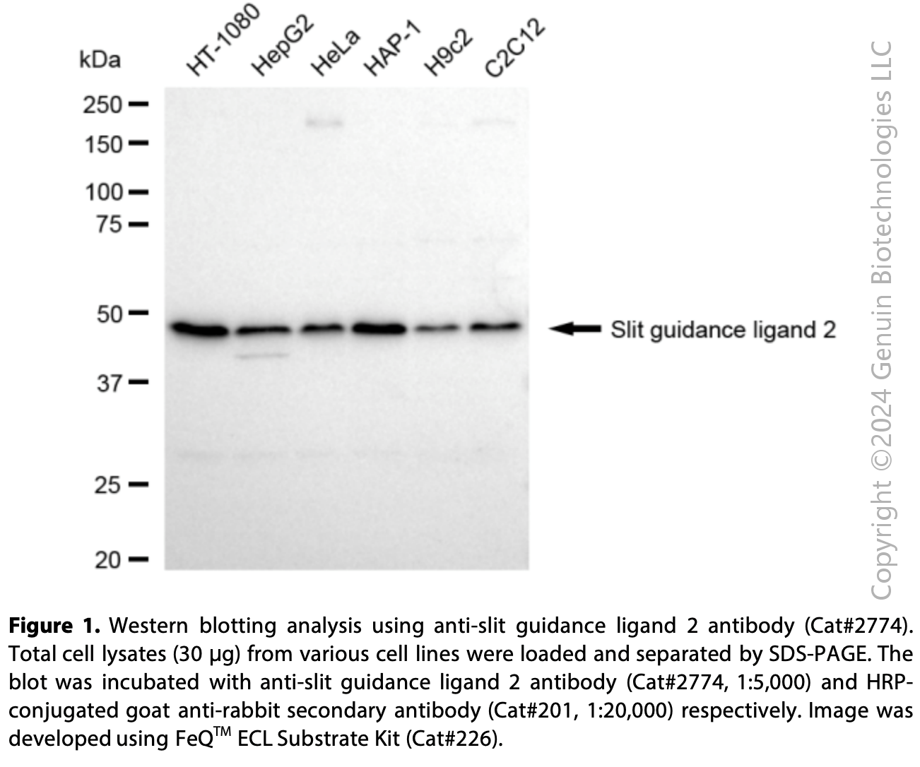 Anti-Slit Guidance Ligand 2 Rabbit mAb #2774