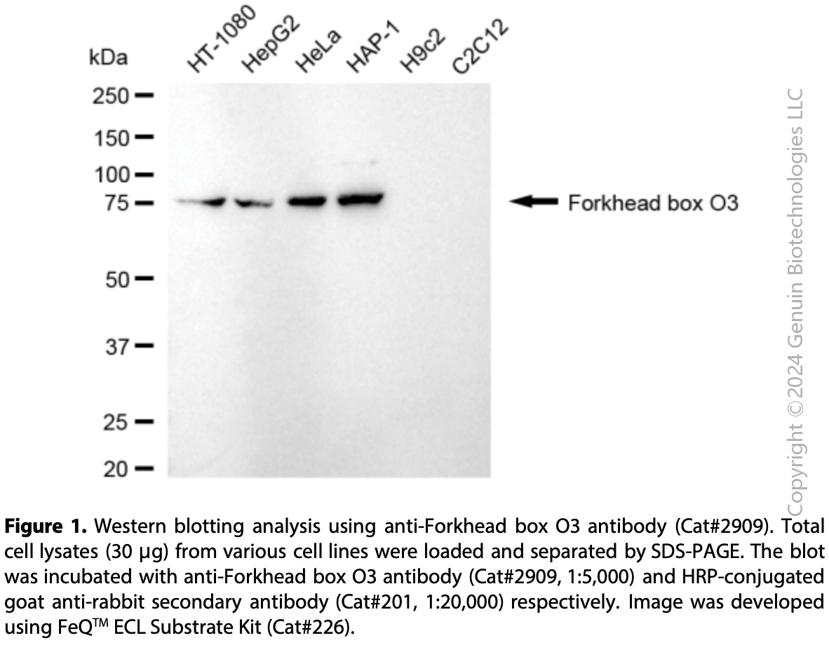 Anti-Forkhead Box O3 Rabbit mAb #2909