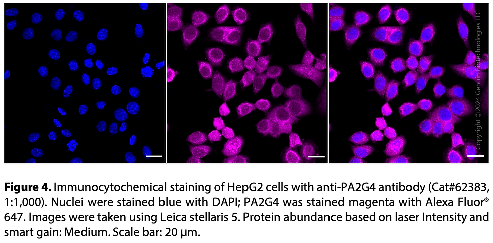 Thumbnail: KD-Validated Anti-Proliferation-Associated 2G4 Rabbit Monoclonal Ab#62383
