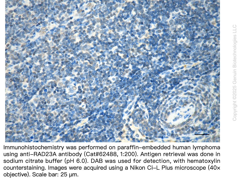 Thumbnail: KD-Validated Anti-RAD23A Rabbit Monoclonal Ab#62488