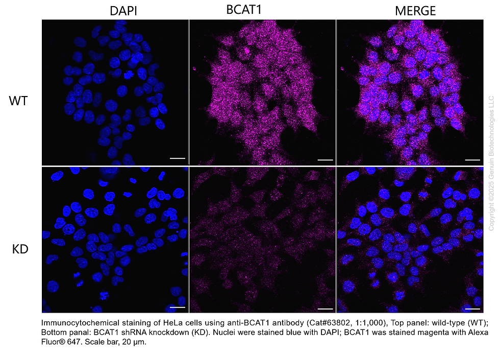 Thumbnail: KD-Validated Anti-BCAT1 Mouse Monoclonal Ab #63802