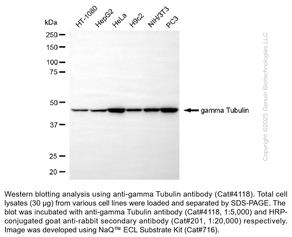 Thumbnail: Anti-Gamma Tubulin Rabbit Monoclonal Ab #4118