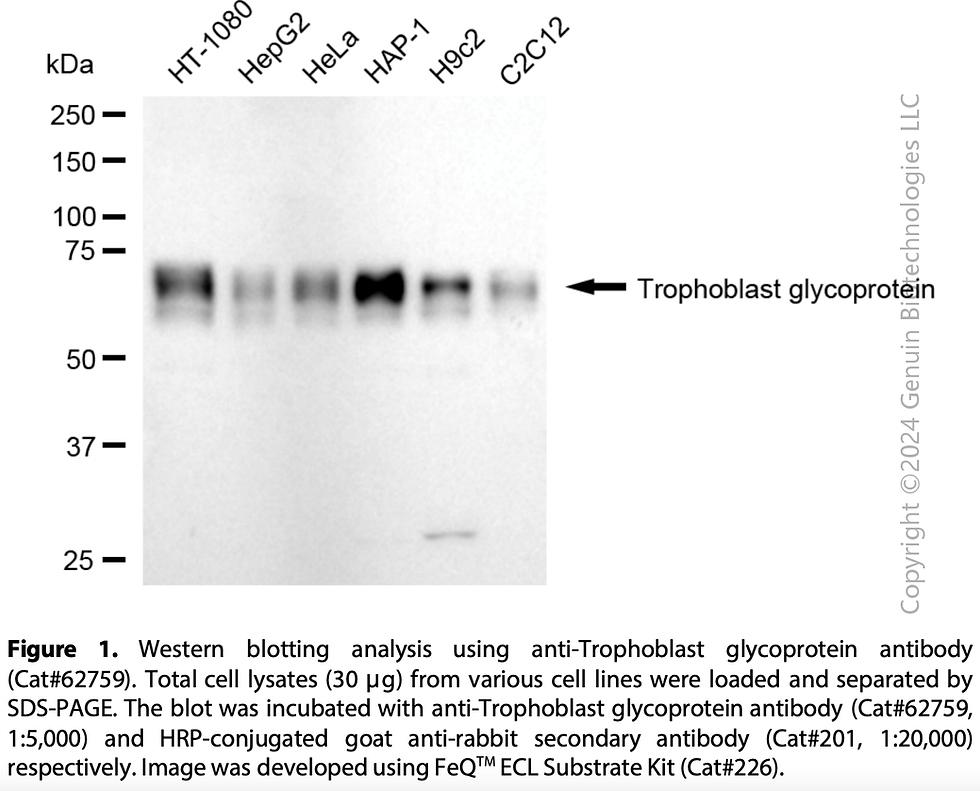 Thumbnail: KD-Validated Anti-Trophoblast Glycoprotein Rabbit Monoclonal Ab#62759