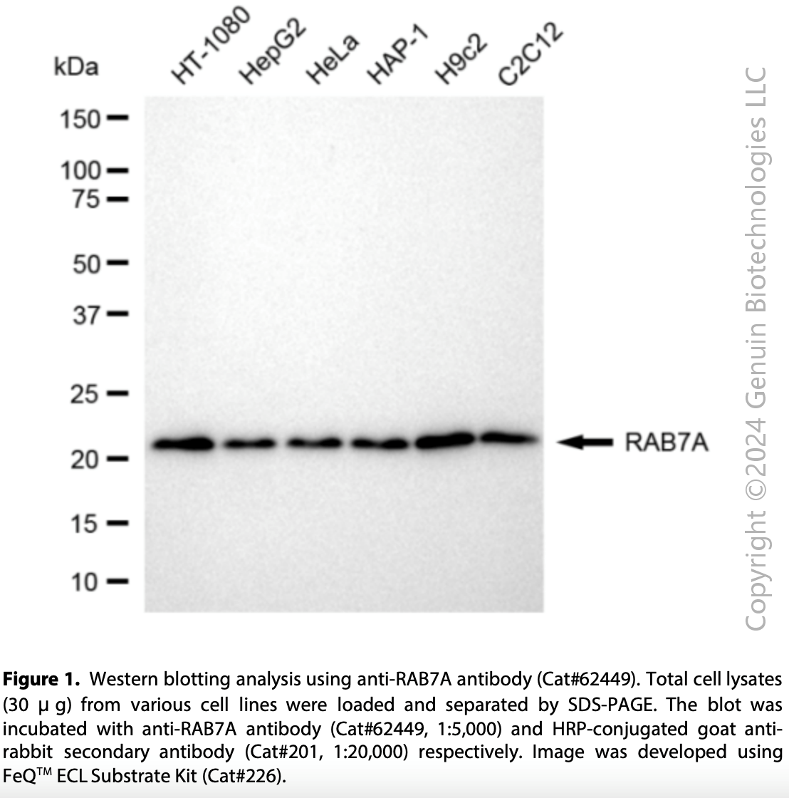 KD-Validated Anti-RAB7 Rabbit Monoclonal Ab#62449