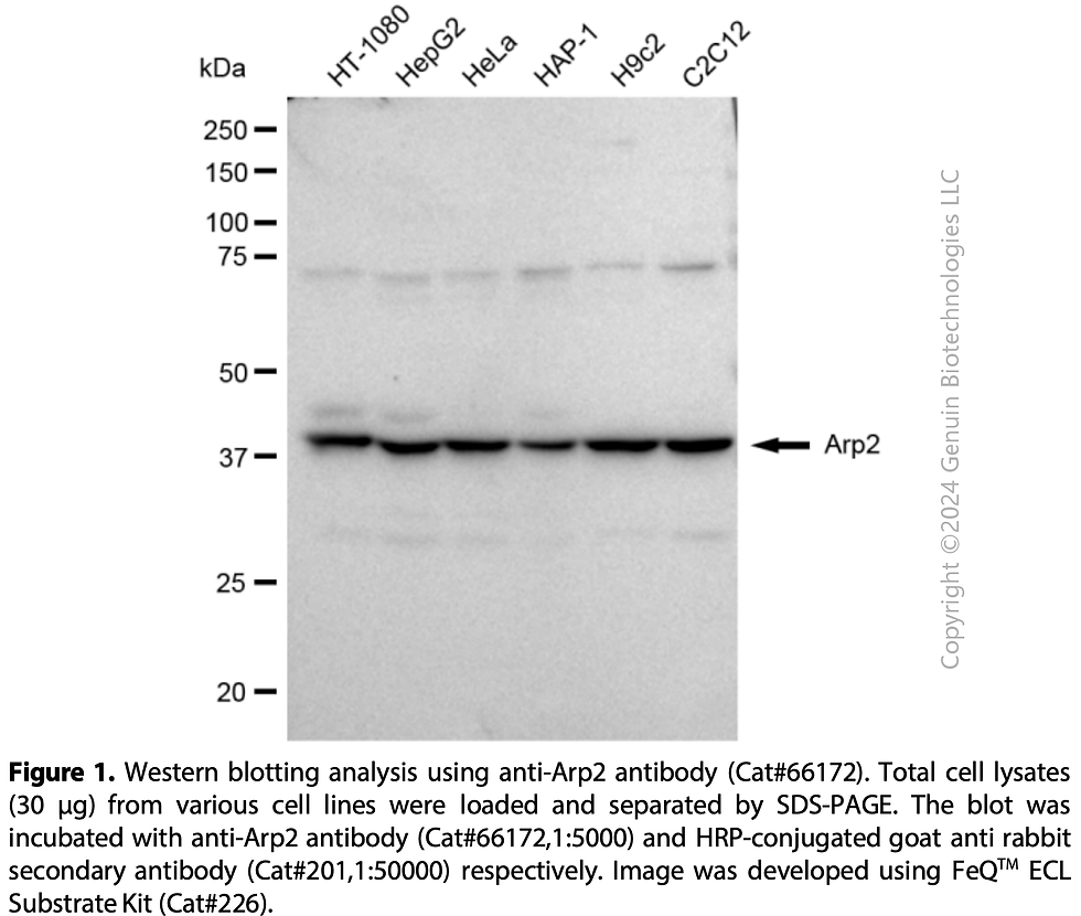 Thumbnail: KD-Validated Anti-Arp2 Rabbit Monoclonal Ab#66172