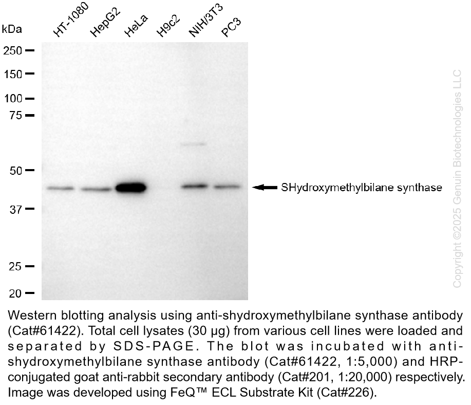 KD-Validated Anti-Hydroxymethylbilane synthase Rabbit mAb #61422