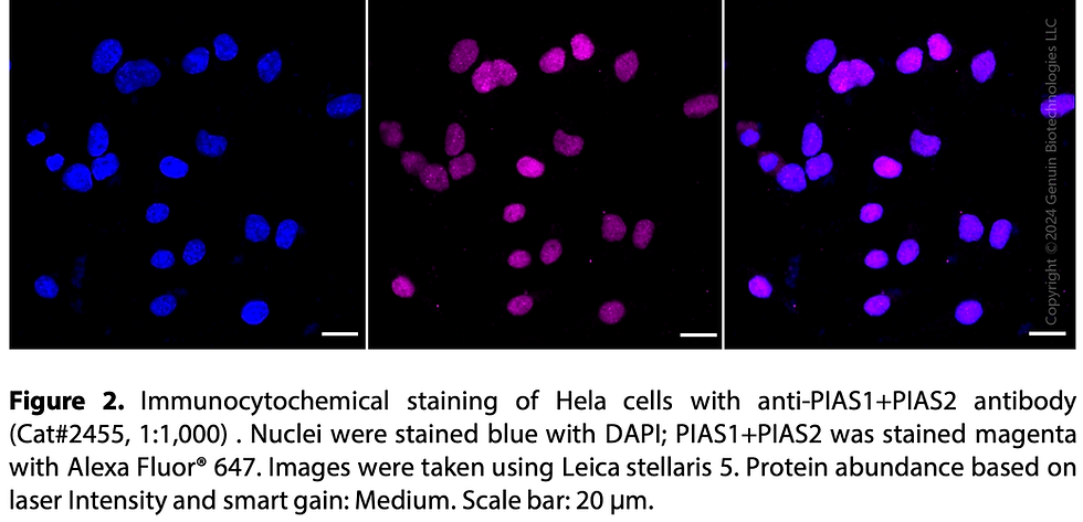 Thumbnail: Anti-PIAS1+PIAS2 Rabbit mAb #2455