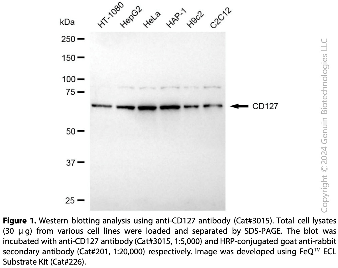 Anti-Interleukin 7 Receptor Rabbit mAb #3015