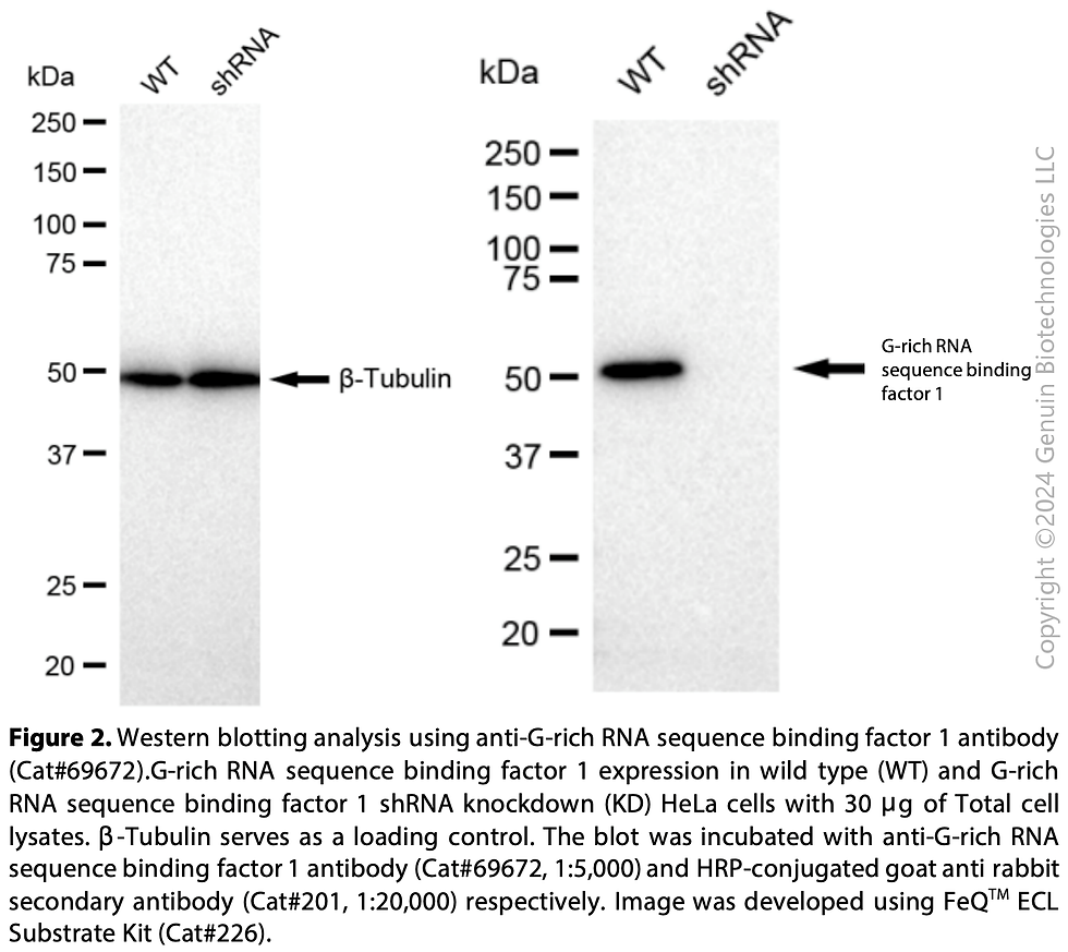 Thumbnail: KD-Validated Anti-G-Rich RNA Sequence Binding Factor 1 Rabbit mAb #69672
