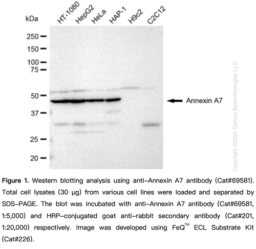 AGR3 (A7) Rabbit mAb main image 0
