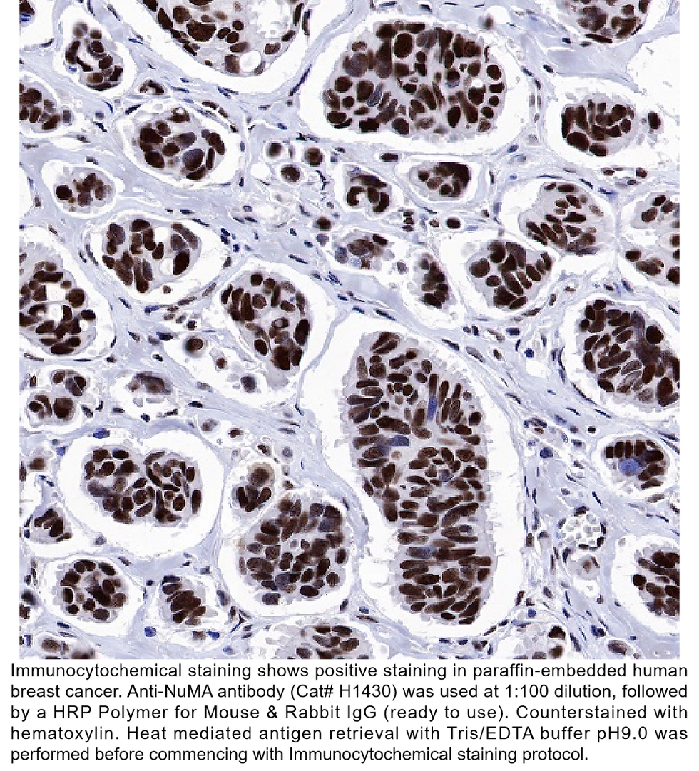 Thumbnail: Anti-NuMA Rabbit Monoclonal Ab #H1430