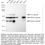Thumbnail: KD-Validated Anti-Legumain Rabbit Monoclonal Ab#65172