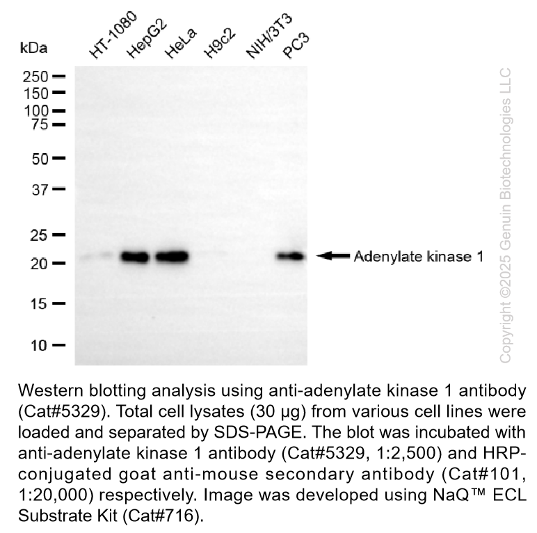 Anti-Adenylate Kinase 1 Mouse Monoclonal Antibody #5329