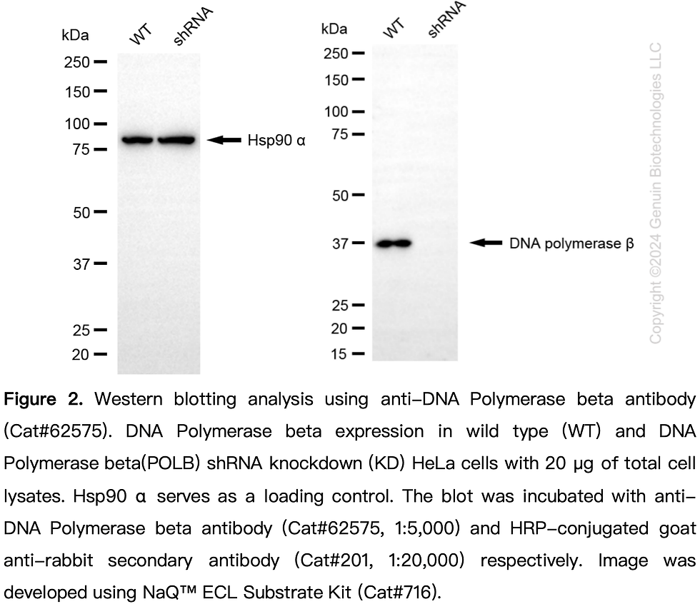 Thumbnail: KD-Validated Anti-DNA Polymerase Beta Rabbit Monoclonal Ab#62575