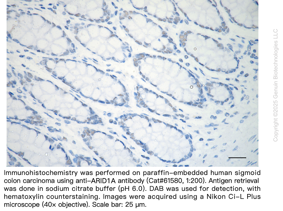 Thumbnail: KD-Validated Anti-ARID1A Rabbit Monoclonal Ab#61580