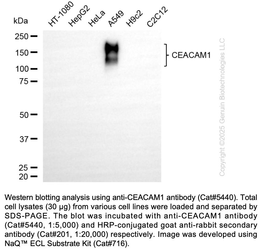 Anti-CEACAM1 Rabbit mAb #5440