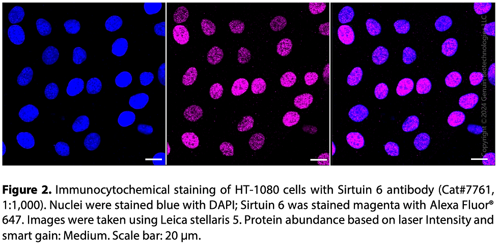 Thumbnail: Anti-Sirtuin 6 Rabbit mAb #7761