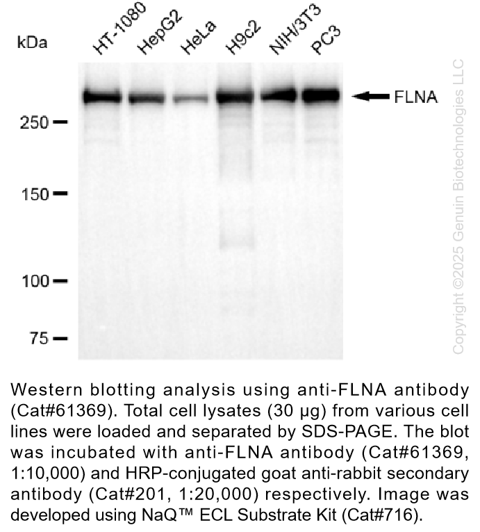 KD-Validated Anti-FLNA Rabbit Monoclonal Ab #61369