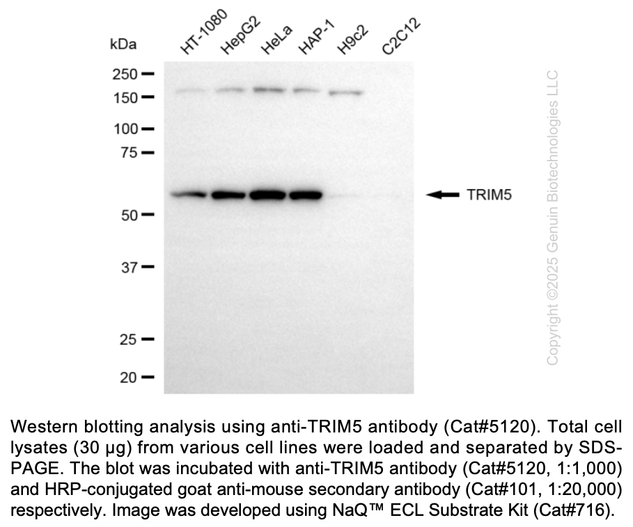 Anti-TRIM5 Mouse Monoclonal Ab #5120