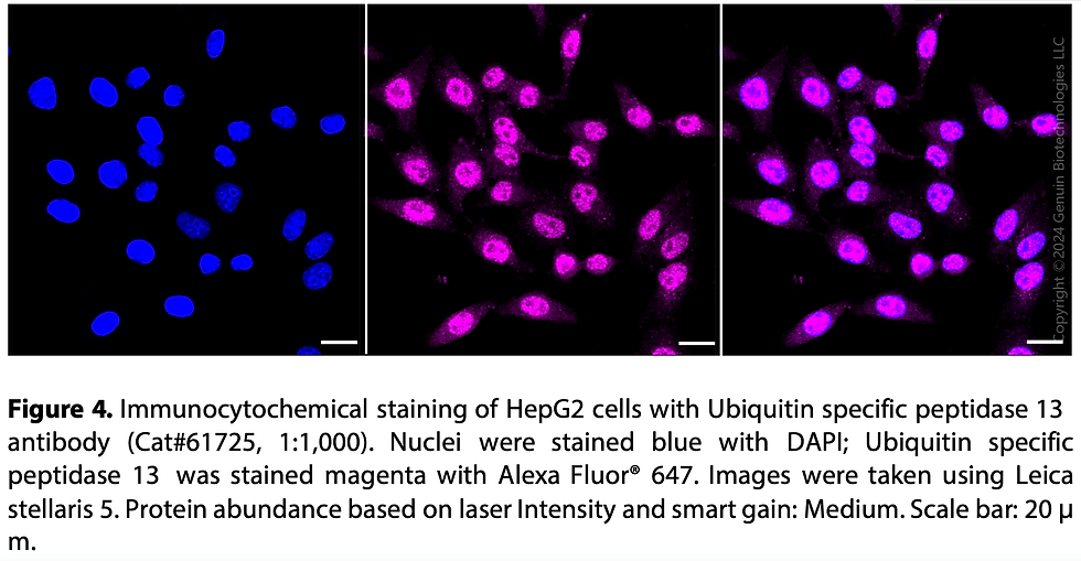Thumbnail: KD-Validated Anti-Ubiquitin specific peptidase 13 Rabbit mAb#61725