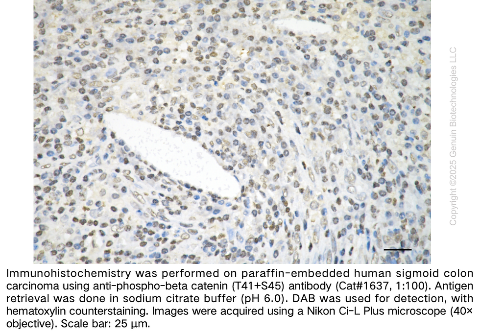Thumbnail: Anti-Phospho-Beta Catenin (T41 + S45) Rabbit mAb #1637