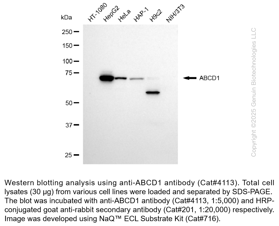 Anti-ABCD1 Rabbit Monoclonal Ab #4113