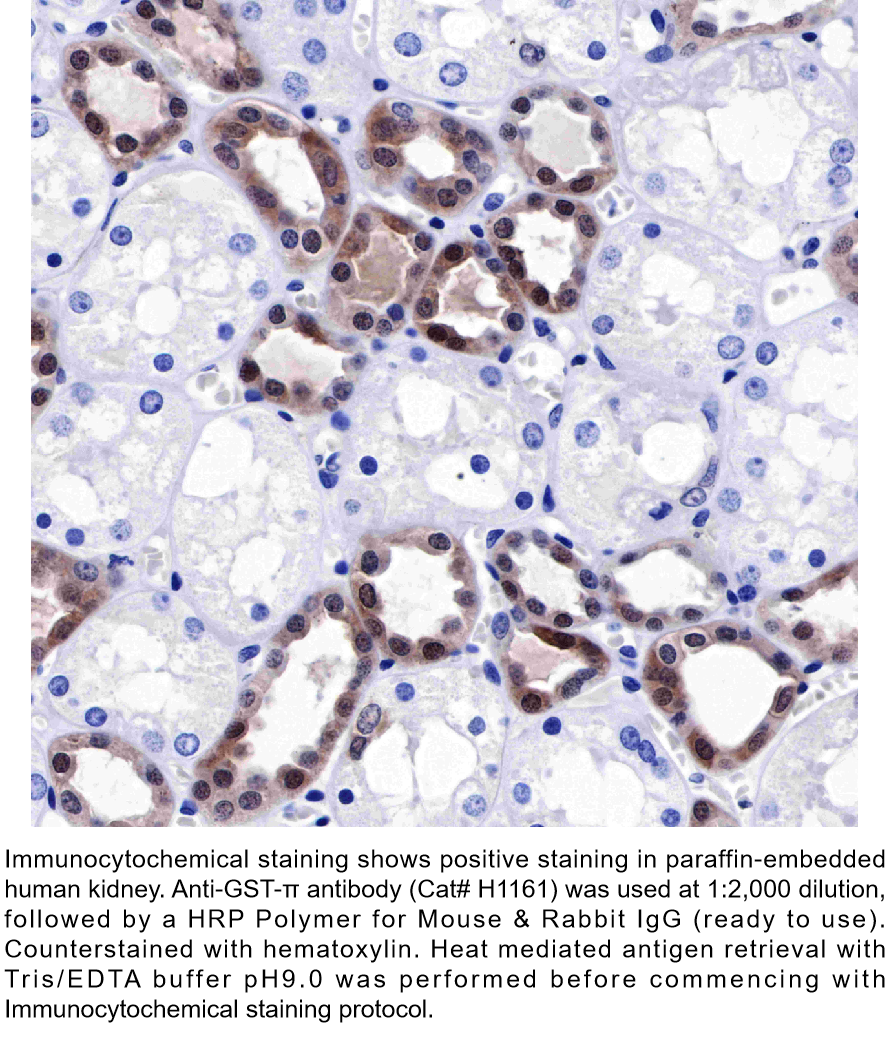 Anti-GST-π Rabbit Monoclonal Ab #H1161