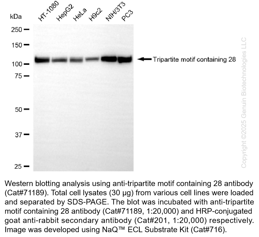 KO-Validated Anti-Tripartite motif containing 28 Rabbit mAb #71189