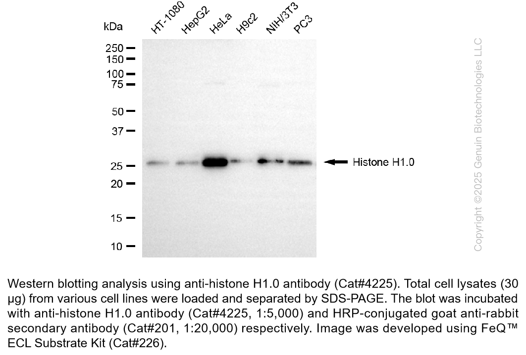 Anti-Histone H1.0 Rabbit Monoclonal Ab #4225