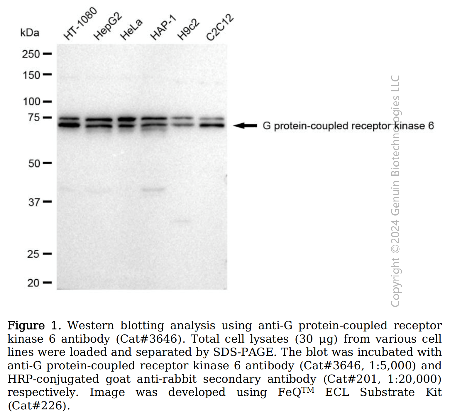 Anti-G protein-coupled receptor kinase 6 Rabbit mAb #3646