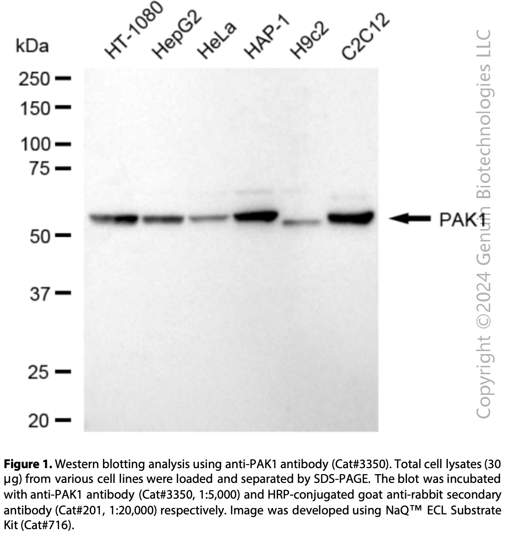 Anti-P21 (RAC1) Activated Kinase 1 Rabbit mAb #3350