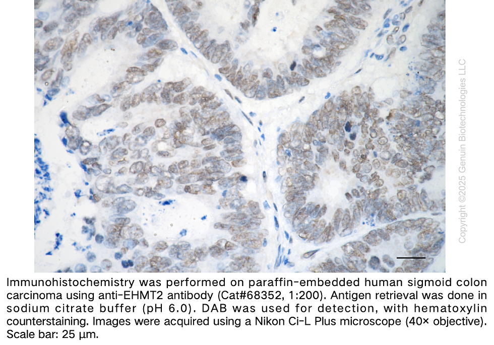Thumbnail: KD-Validated Anti-EHMT2 Rabbit Monoclonal Ab#68352