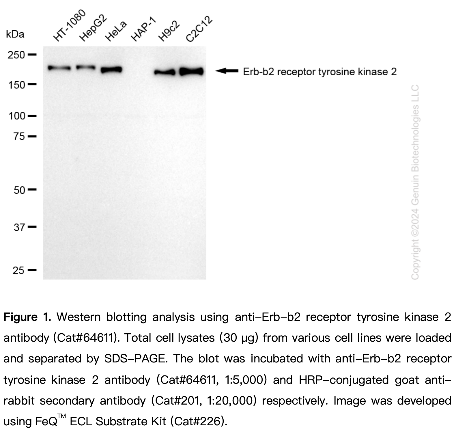 KD-Validated Anti-Erb-B2 Receptor Tyrosine Kinase 2 Rabbit Monoclonal Ab#64611