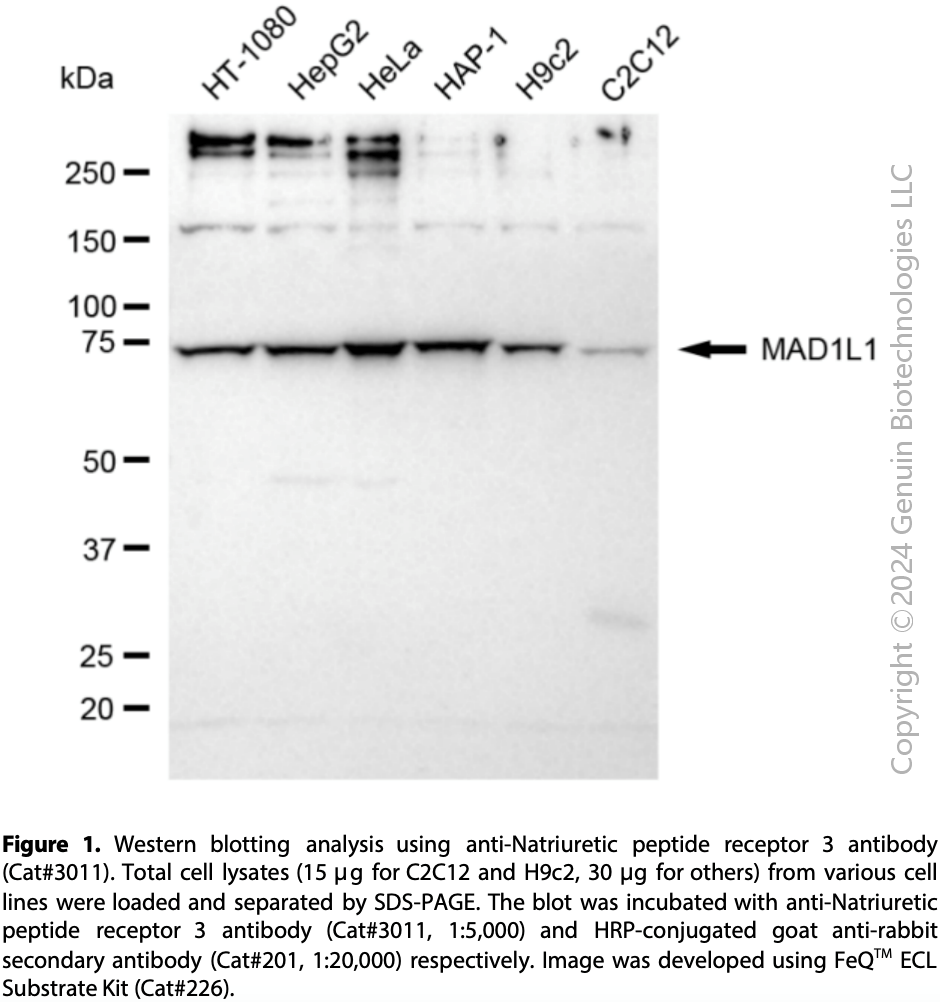 Anti-Mitotic Arrest Deficient 1 Like 1 Rabbit mAb #3011