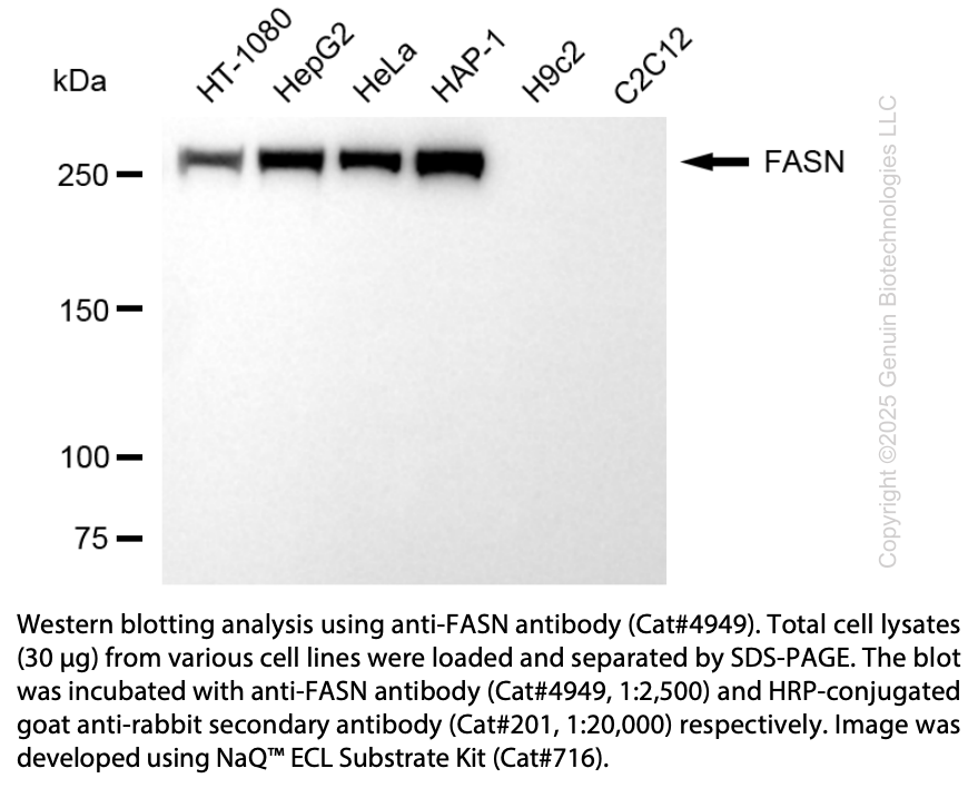Anti-FASN Rabbit Polyclonal Ab #4949