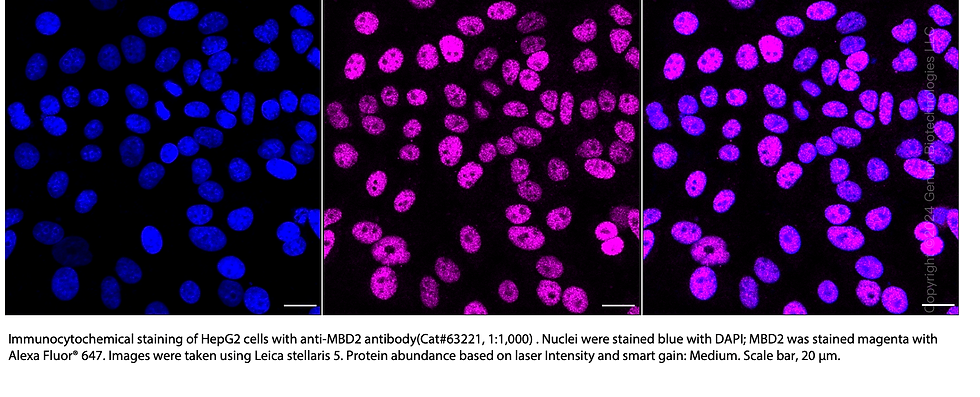 Thumbnail: KD-Validated Anti-Methyl-CpG Binding Domain Protein 2 Rabbit Monoclonal Ab#63221