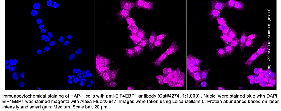 Thumbnail: Anti-EIF4EBP1 Rabbit Monoclonal Ab #4274