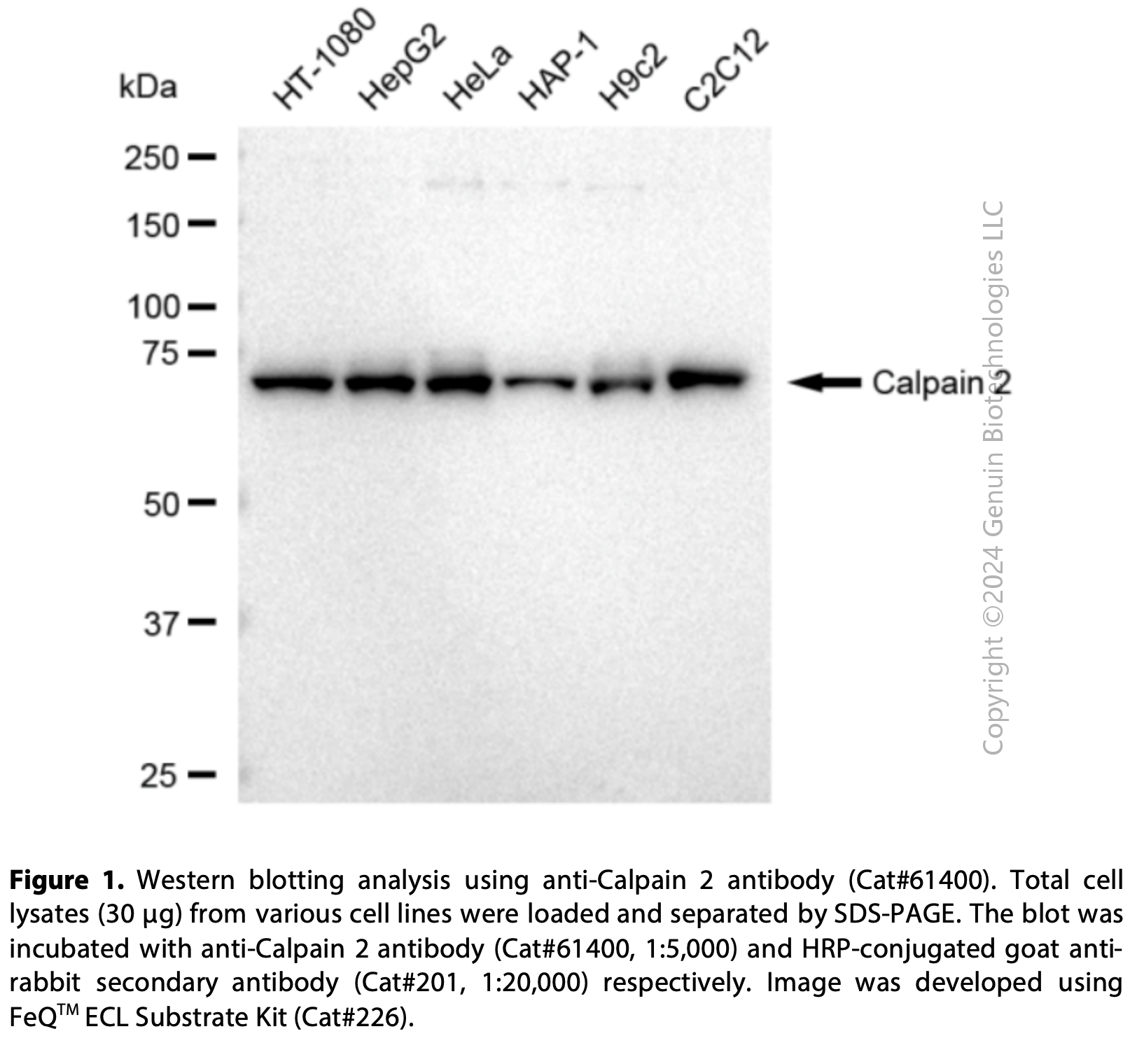 KD-Validated Anti-Calpain 2 Rabbit Monoclonal Ab#61400