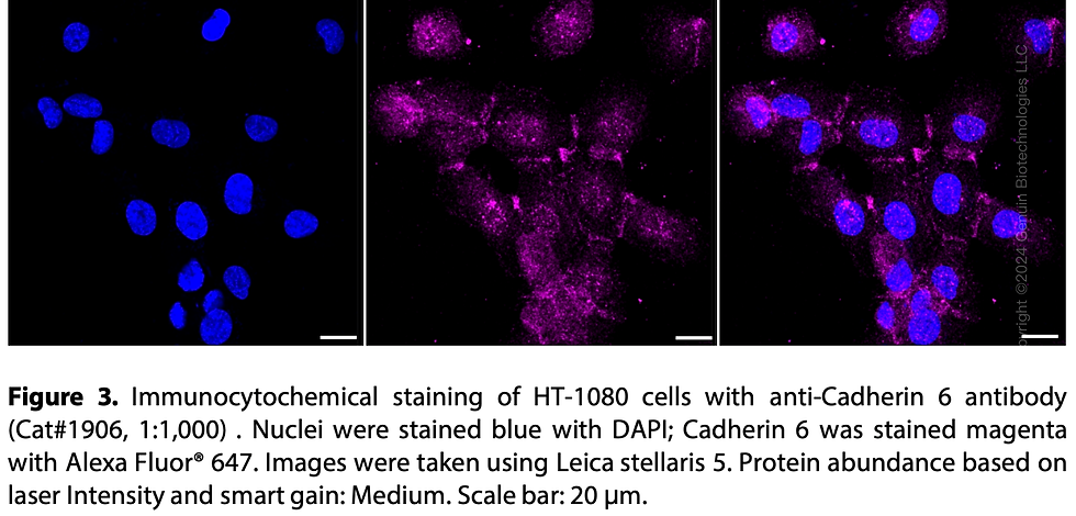 Thumbnail: Anti-Cadherin 6 Rabbit mAb #1906