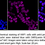 Thumbnail: Anti-Lamin B Receptor Rabbit mAb #2121