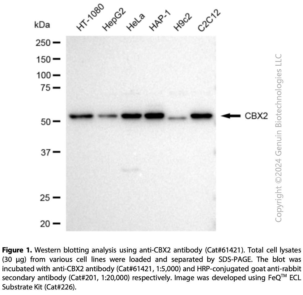 Thumbnail: KD-Validated Anti-CBX2 Rabbit Monoclonal Ab#61421