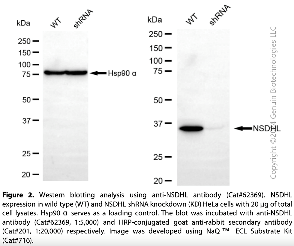 Thumbnail: KD-Validated Anti-NSDHL Rabbit Monoclonal Ab#62369