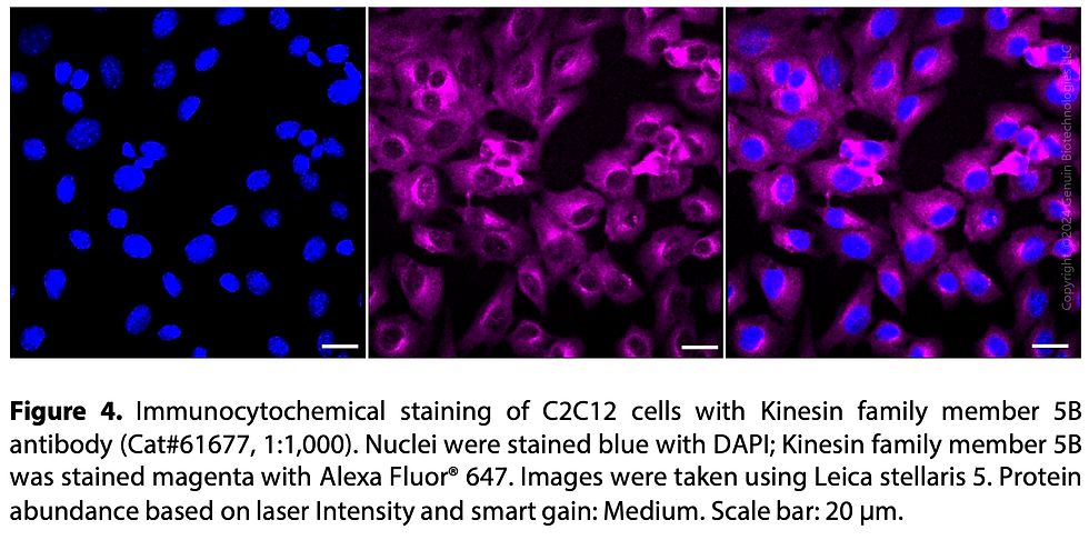 Thumbnail: KD-Validated Anti-Kinesin Family Member 5B Rabbit Monoclonal Ab#61677