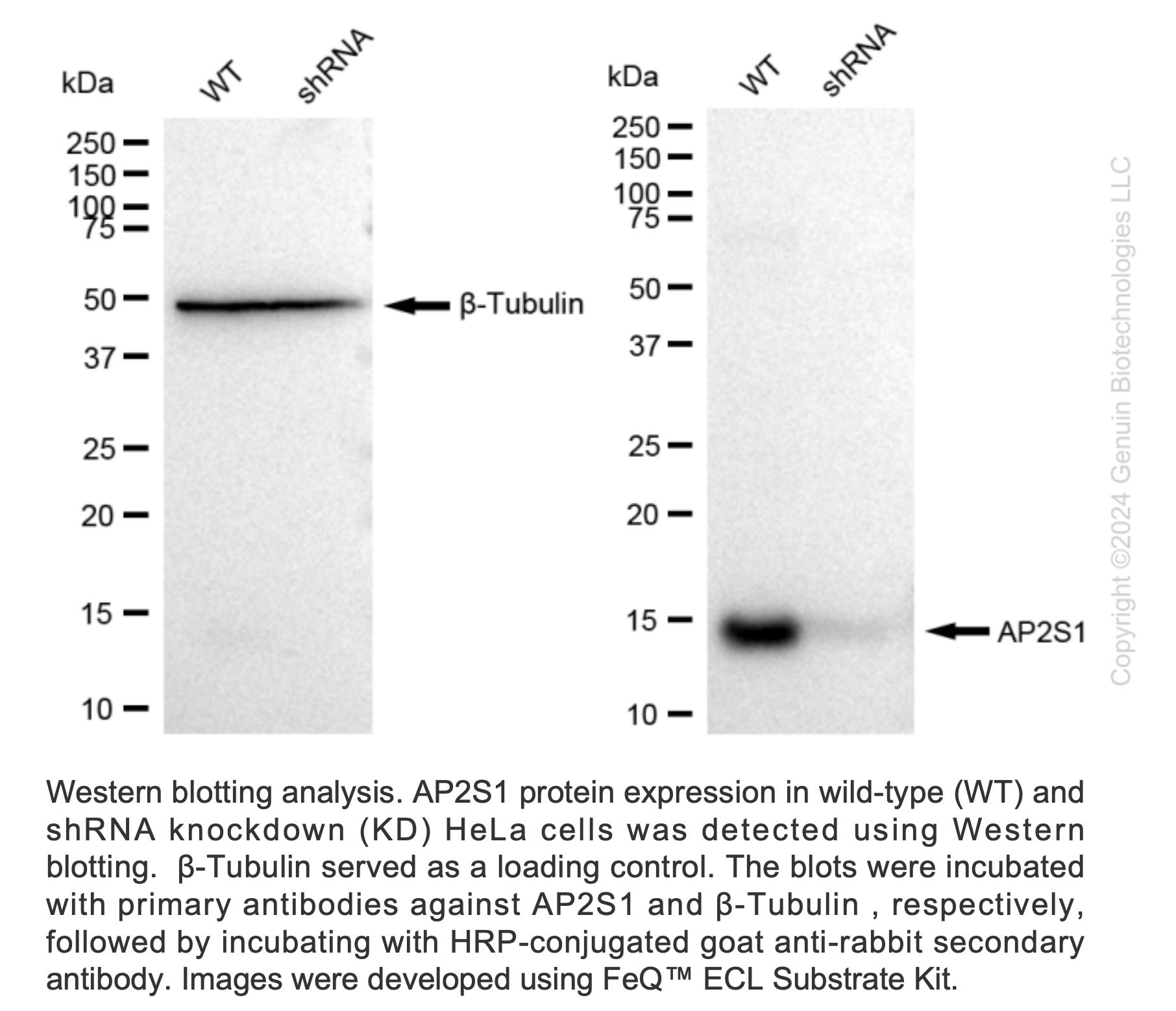 WB-Validated AP2S1 Knockdown Cell Lysate Kit#L61452