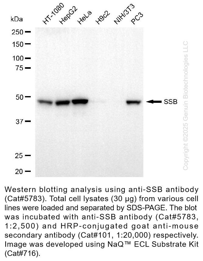 Anti-SSB Mouse Monoclonal Ab #5783