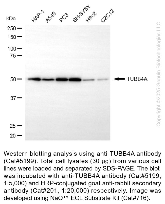 Anti-TUBB4A Rabbit Monoclonal Antibody #5199
