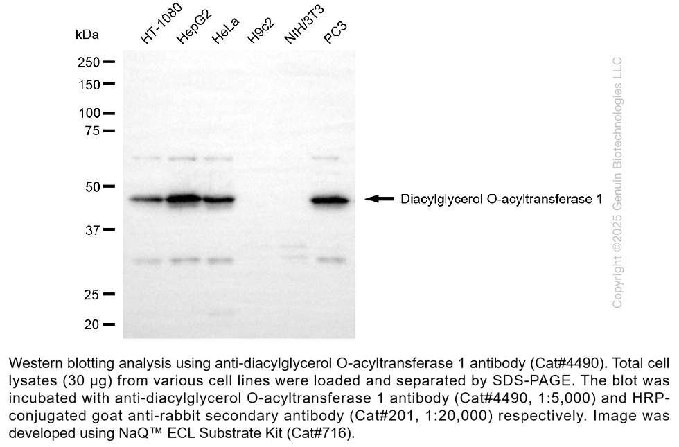 Thumbnail: Anti-Diacylglycerol O-acyltransferase 1 Rabbit Monoclonal Ab #4490