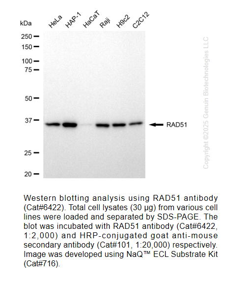 RAD51 Mouse mAb #6422